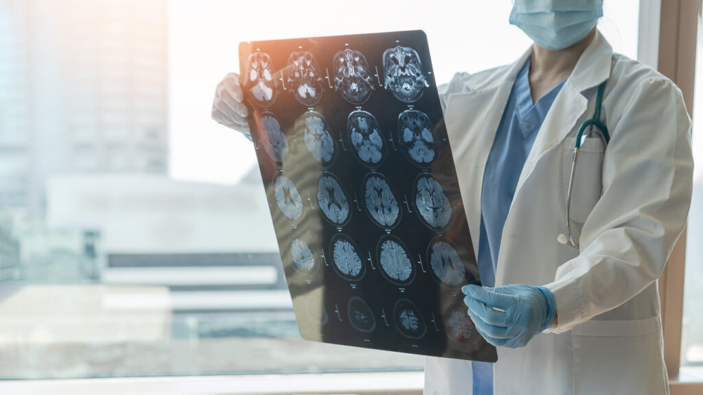 Lawyer reviewing traumatic brain injury settlement case in Maine for client with long-term cognitive effects
